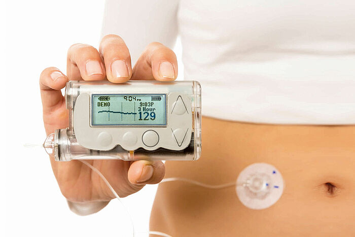 Bürstenlose DC-Motoren für Insulinpumpe vereinfacht das Leben mit Diabetes